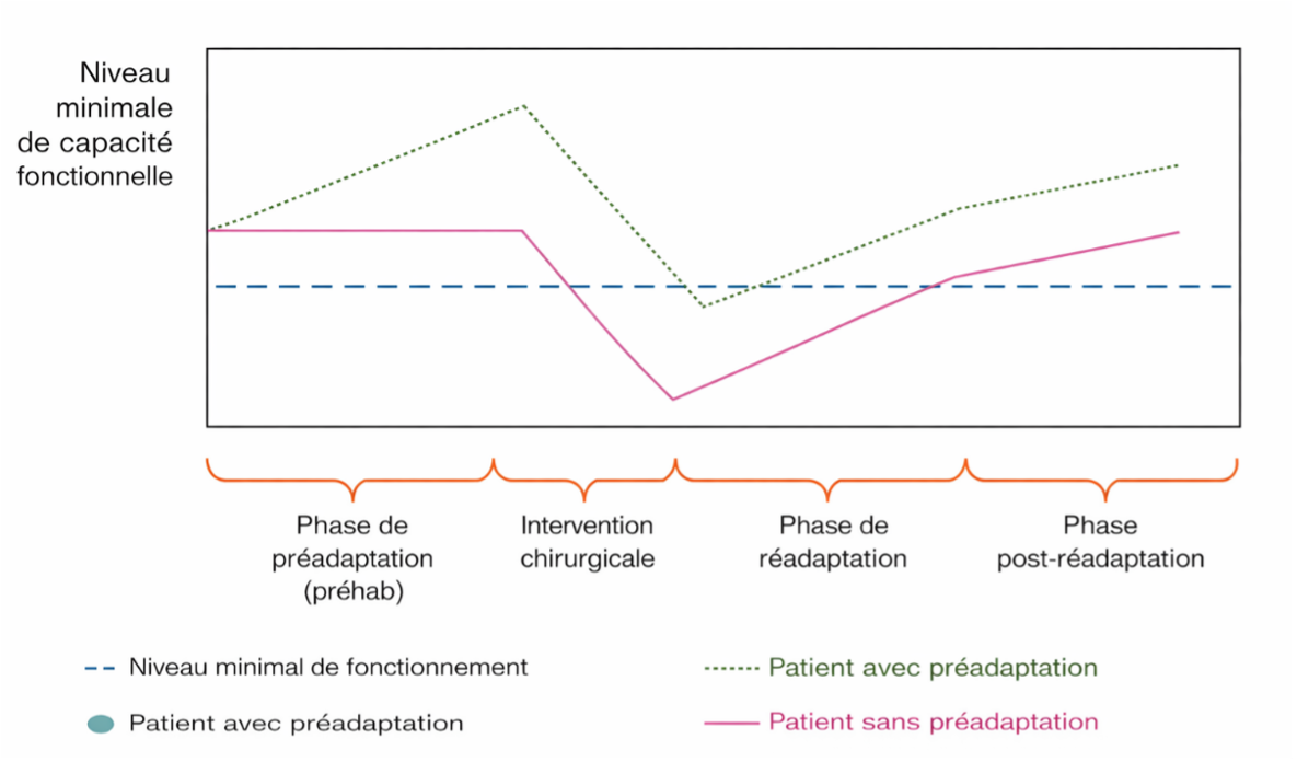 Graphique comparant l’évolution de la capacité fonctionnelle chez un patient avec et sans préadaptation avant une intervention chirurgicale.